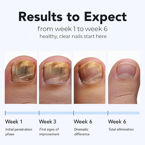Simpli™ Fungal Nail Patches