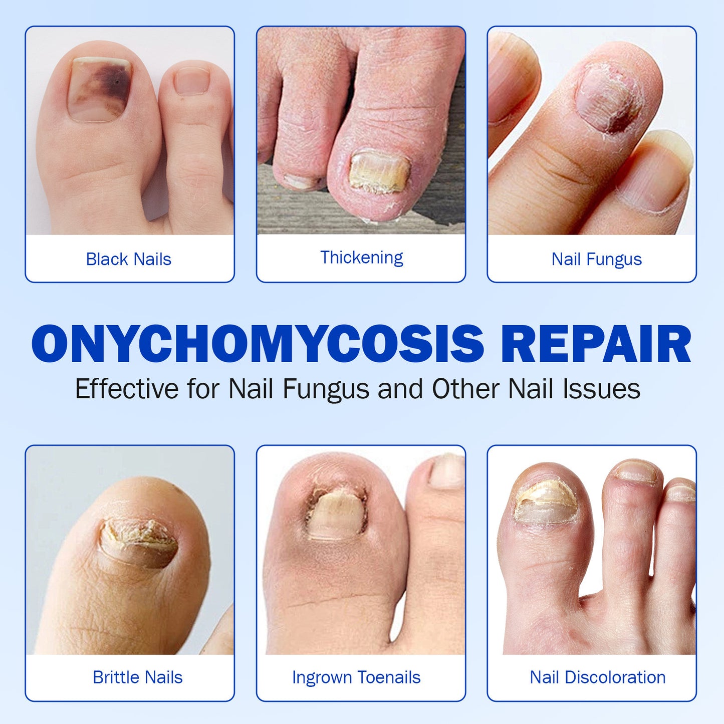 Simpli™ Fungal Nail Patches