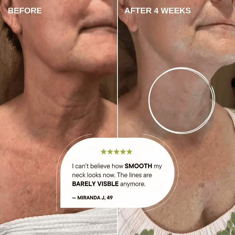 Simpli™ Retinal Cream