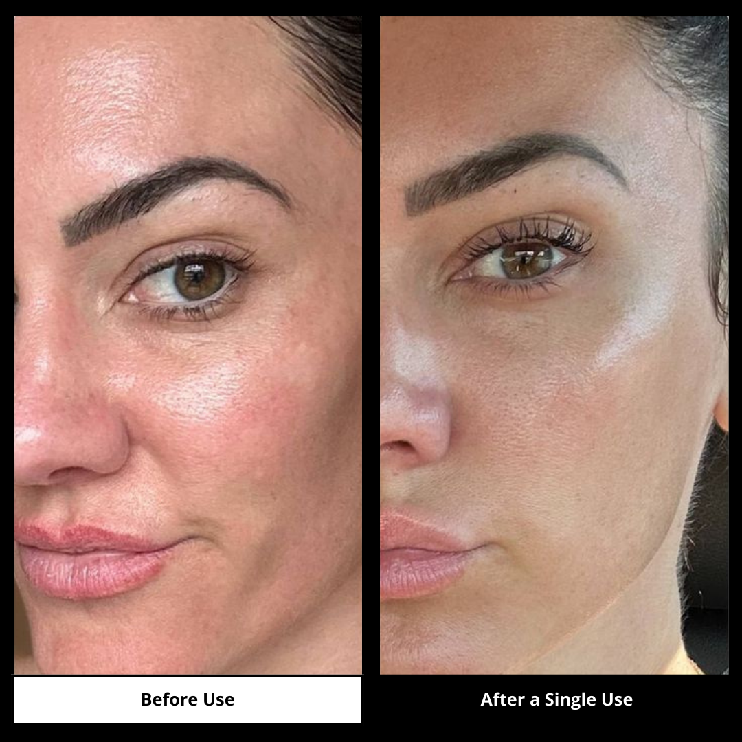 Simpli™ Retinal Cream