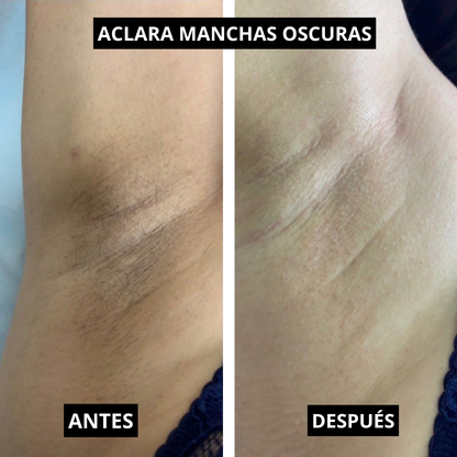 Simpli™ Lumina Fresh