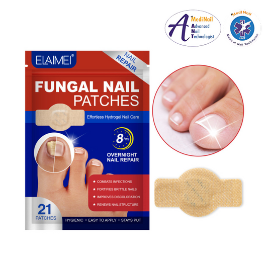Simpli™ Fungal Nail Patches