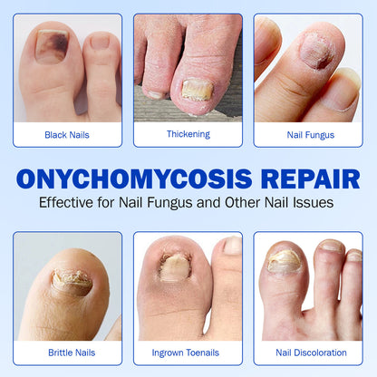 Simpli™ Fungal Nail Patches